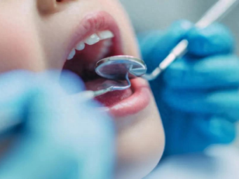 4岁男孩拔牙身亡，该全麻吗？